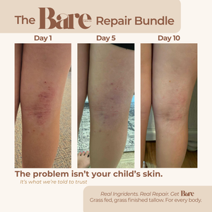 Bare Repair Bundle |  Repair for Every Age.