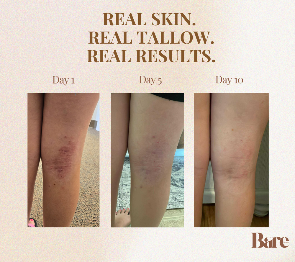 The Repair Collection |  Repair for Every Age.