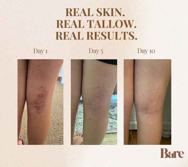 Remedy | Deep Repair for Sensitive Skin