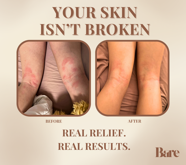 Remedy | Deep Repair for Sensitive Skin